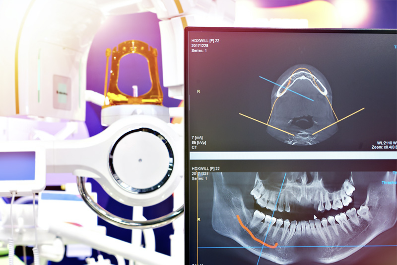 Digital X-Rays in Pearland