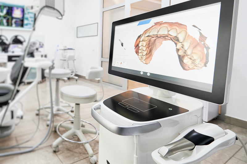 Intra-Oral Scanner in Pearland